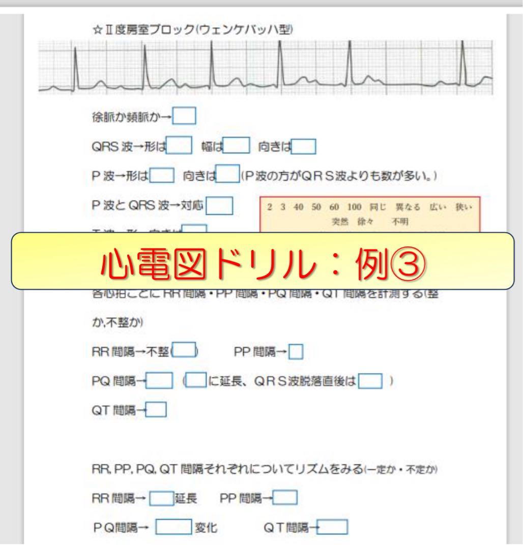 心電図検定対策7点セット