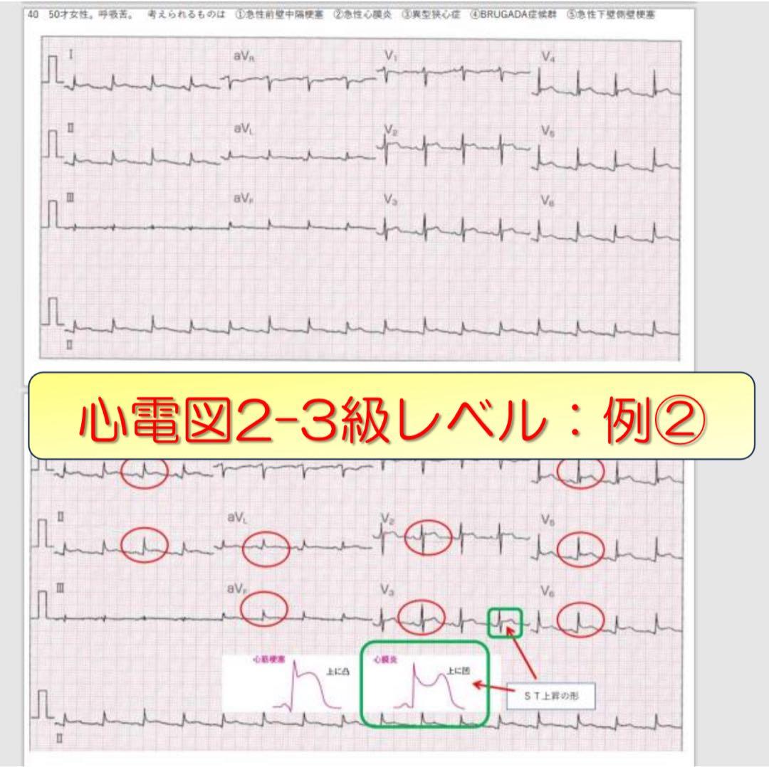心電図検定対策7点セット