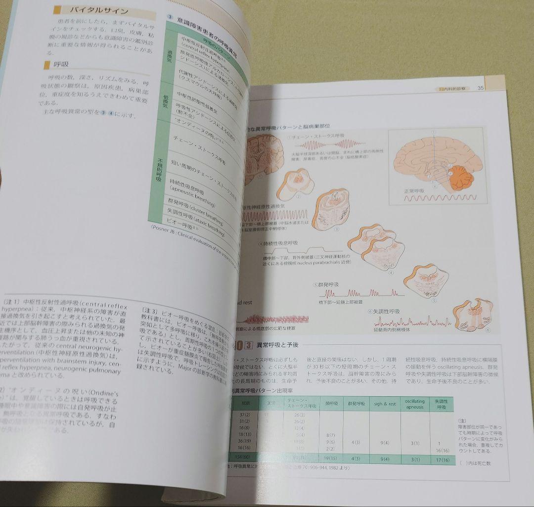脳卒中ビジュアルテキスト
