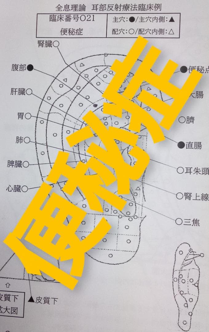 Bc:耳つぼ学ぶ：耳臨床54例集+臓器/躯体ラミネート+解説冊子/プリントset