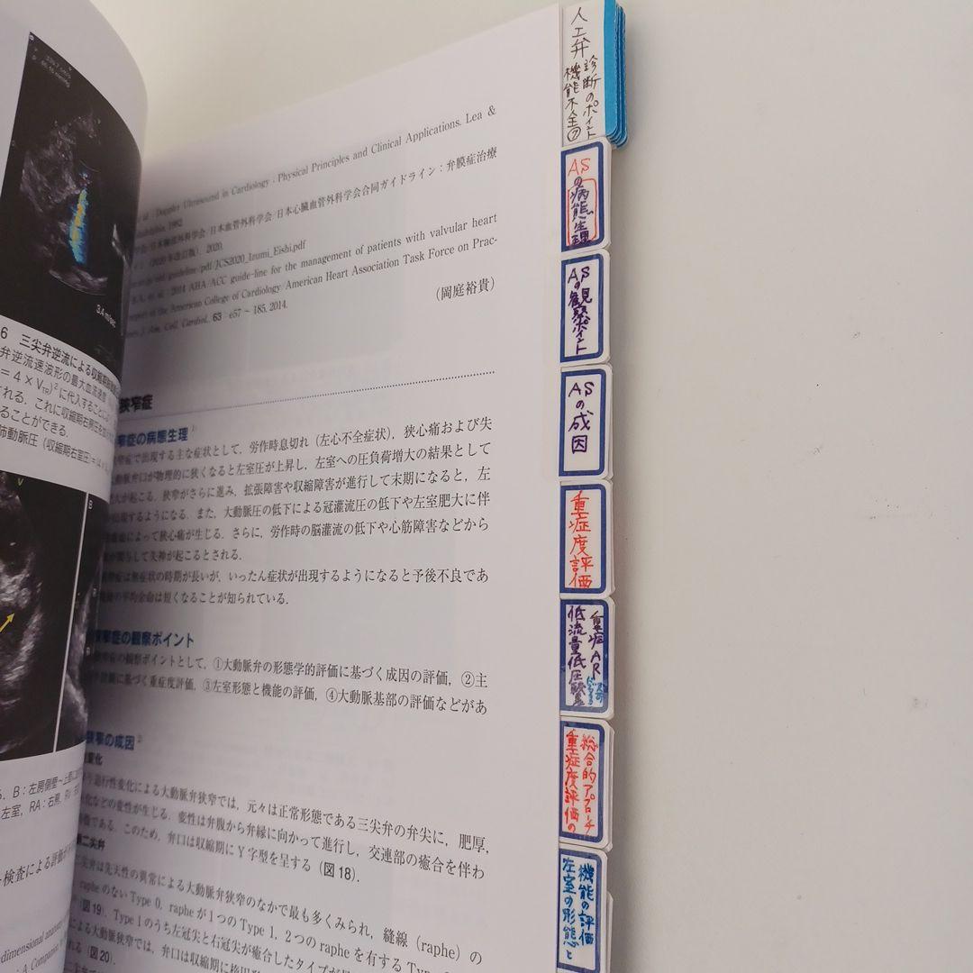 心臓超音波テキスト 第3版