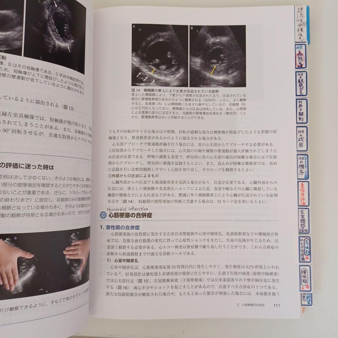 心臓超音波テキスト 第3版