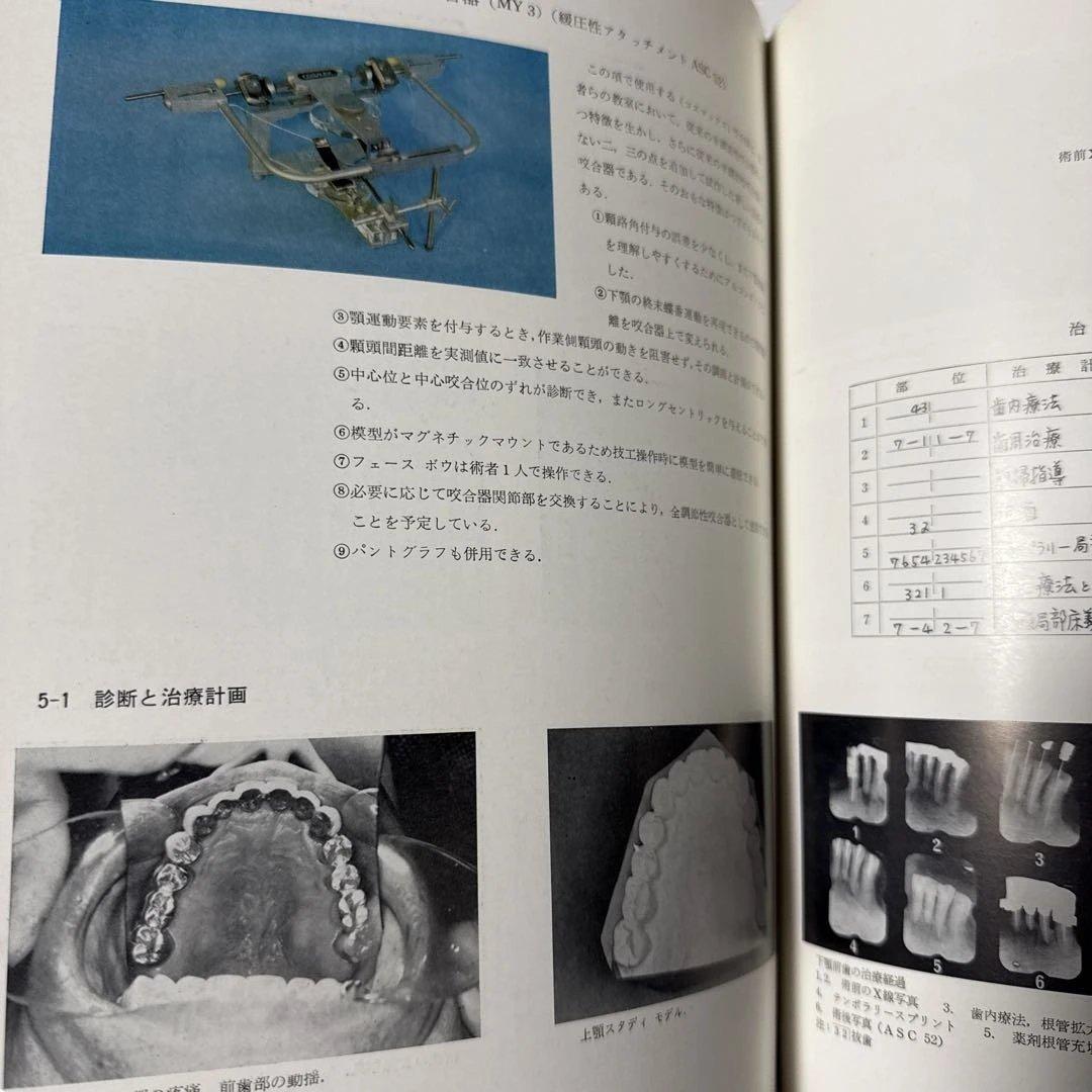 最新歯科補綴アトラス
