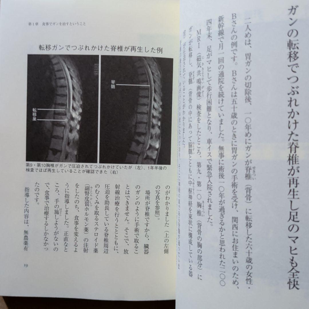 今あるガンが消えていく食事 : 進行ガンでも有効率66.3%の奇跡　ガン治療