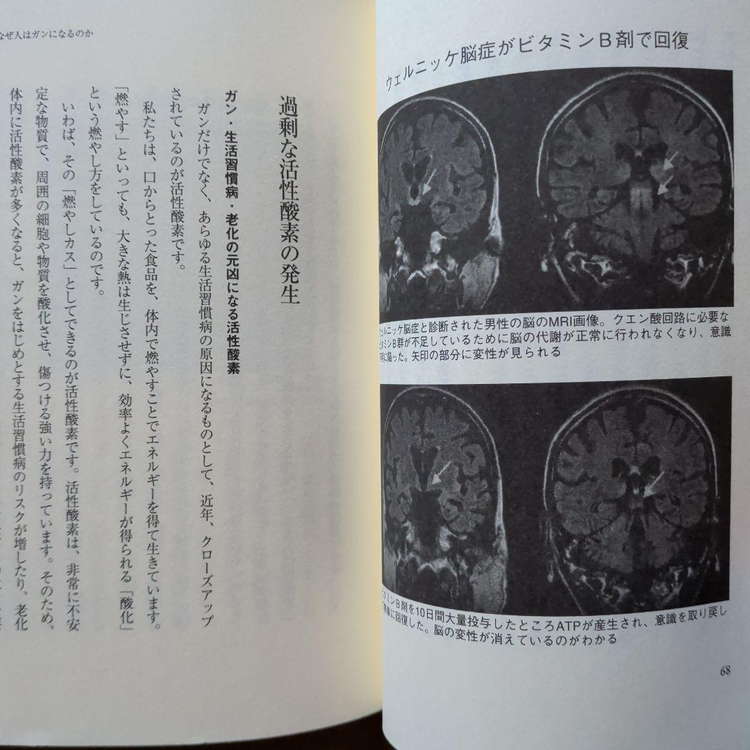 今あるガンが消えていく食事 : 進行ガンでも有効率66.3%の奇跡　ガン治療