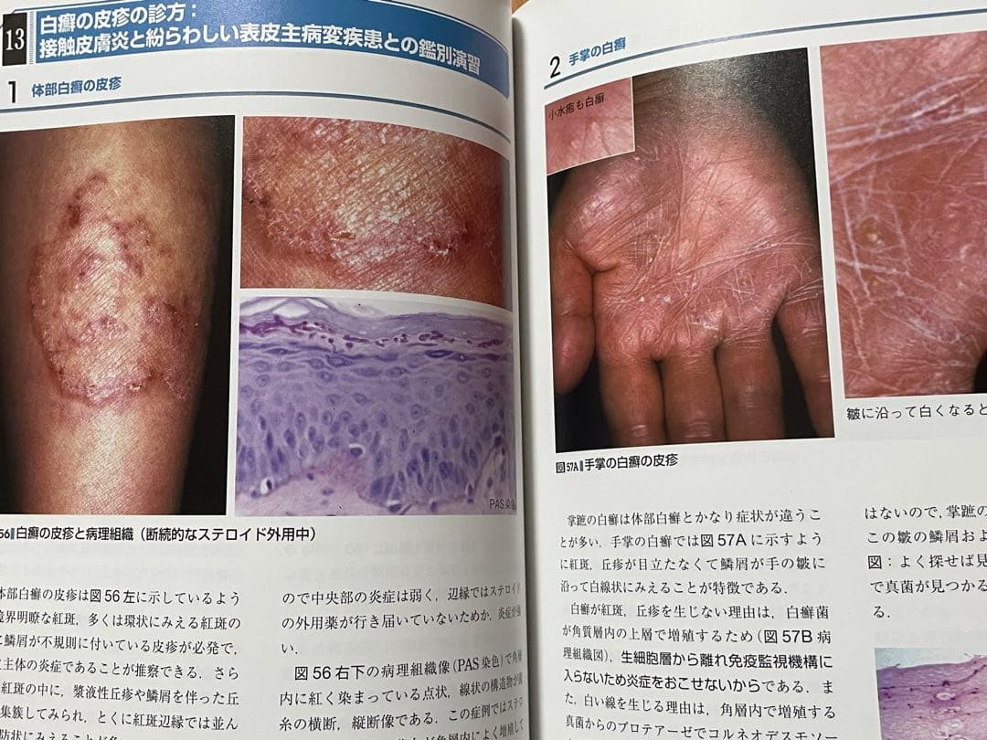 皮疹の因数分解・ロジック診断