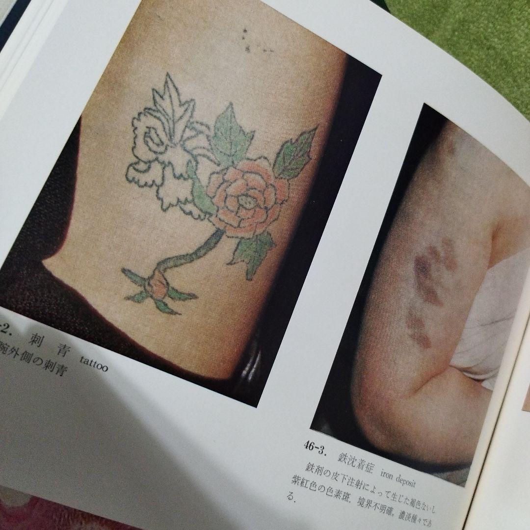 Netter 医学図譜集 全9巻 皮膚病アトラス　セット