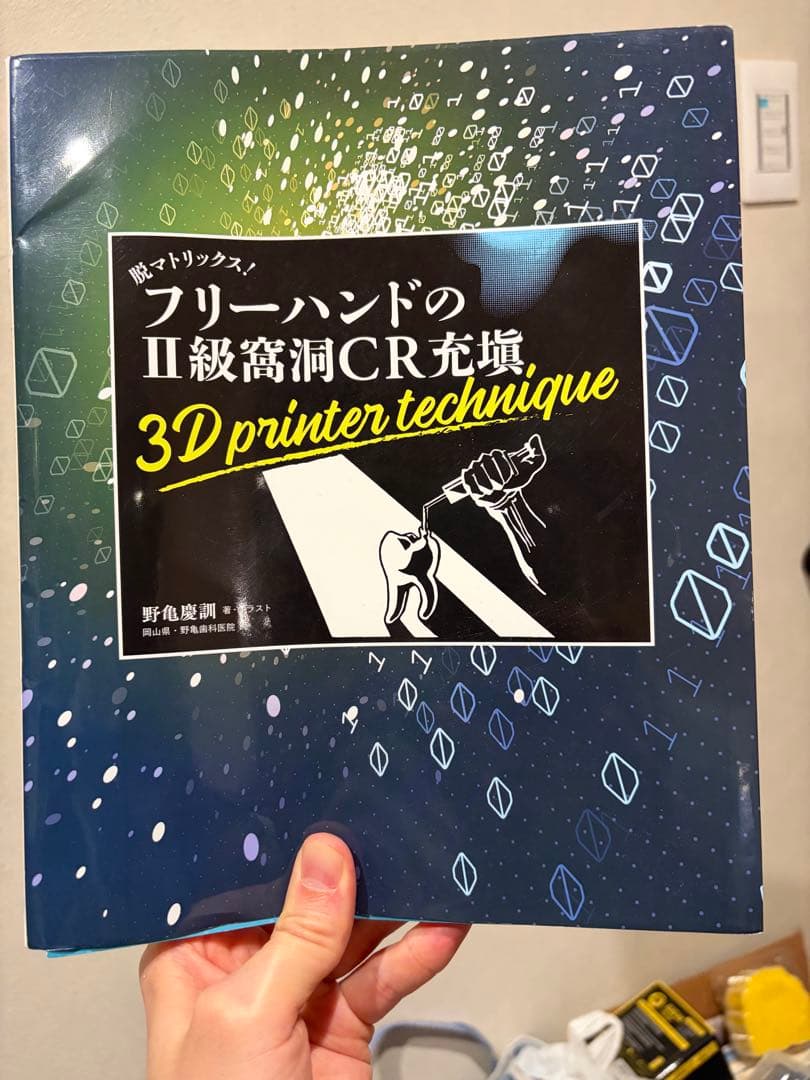 【裁断済】フリーハンドのII級窩洞CR充填 3Dプリンターテクニック