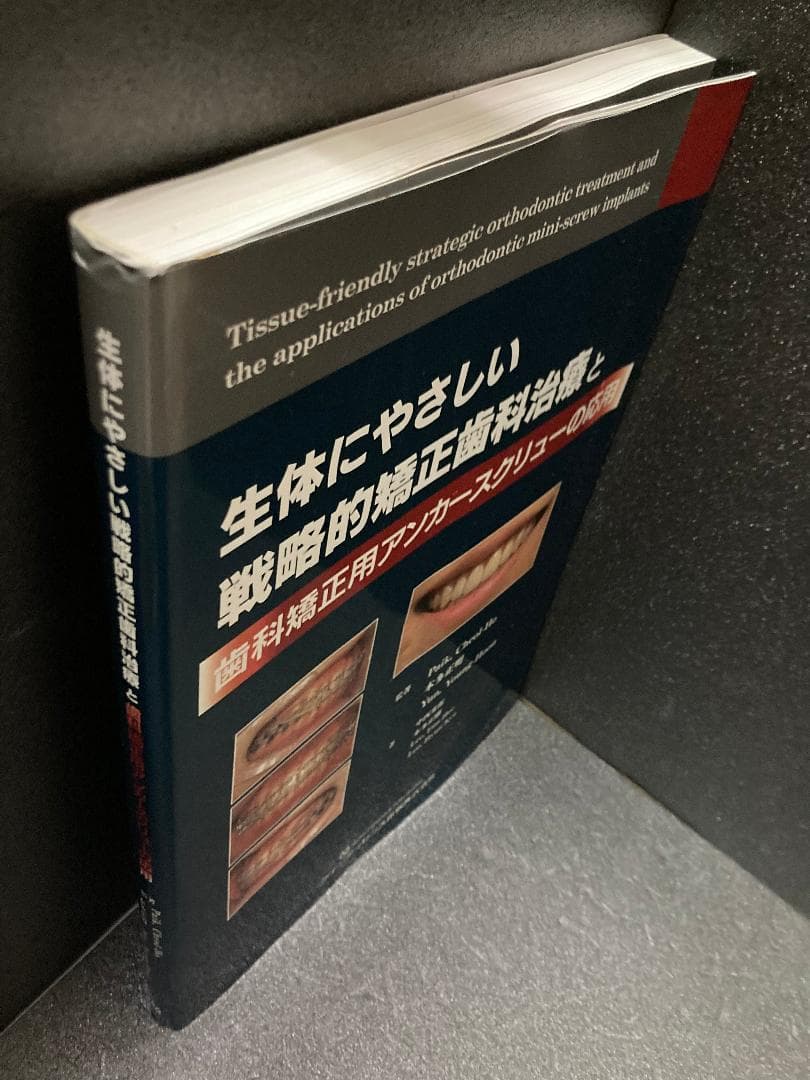 生体にやさしい戦略的矯正歯科治療と歯科矯正用アンカースクリューの応用
