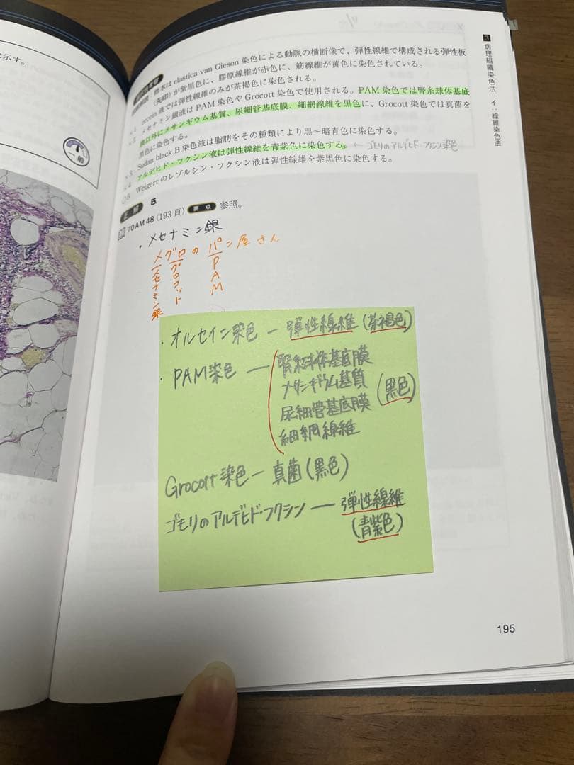 臨床検査技師国家試験解説集Complete+MT2025 黒本 8冊セット