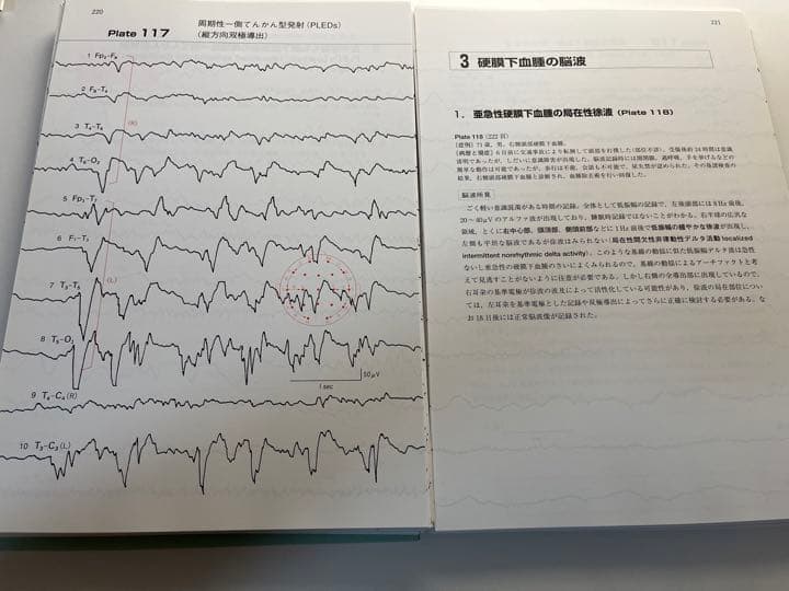 ☆裁断済み☆脳波判読step by step 症例編第4版