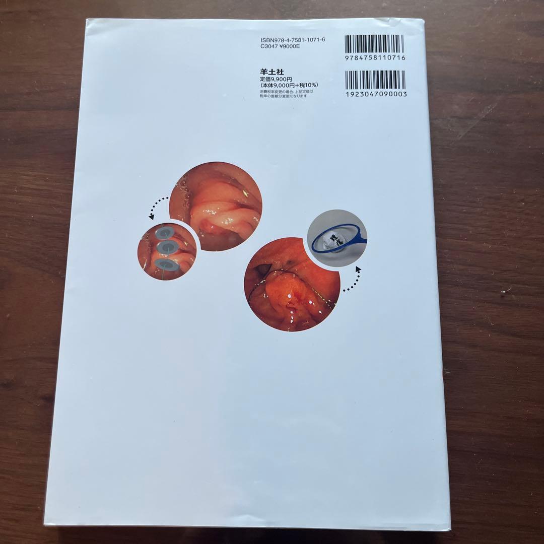 これで完璧！　胆膵内視鏡の基本とコツ