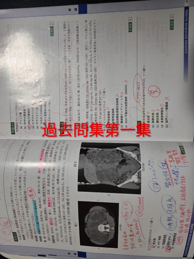 日本内科学会 過去問題集 その他、 内科専門医 総合内科専門医、ジャンク